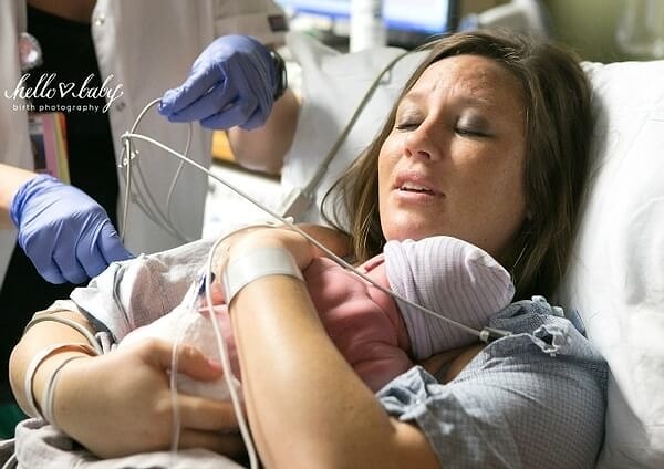 17. Мать, впервые взявшая на руки младенца, после наркоза.