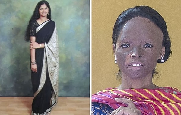 «Я начала постепенно показывать свое лицо. И если другие девушки, выжившие после нападения, увидят, что я это делаю, то почему бы и им не попробовать?» - объяснила Лакшми.