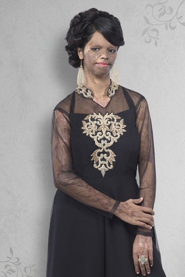 «Для меня это возможность показать на своем примере, что женщины с такими же проблемами, как и у меня, могут быть уверенными и отважными...».