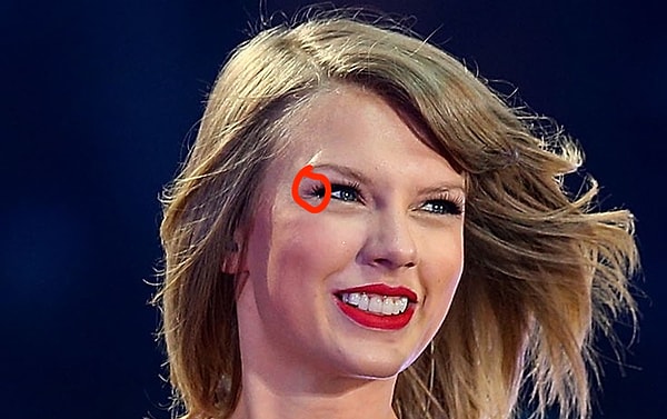 8. Кантус - наружный угол глаза.