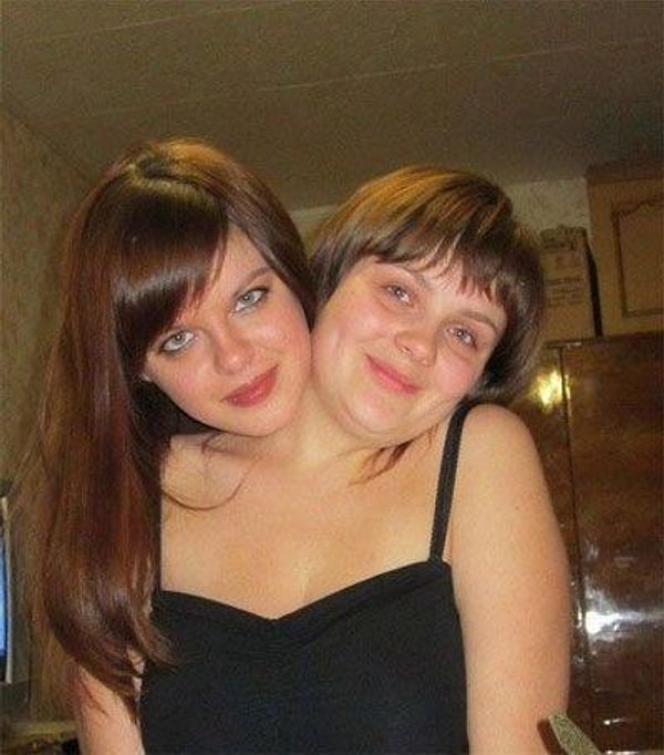 22. И опять сиамские близняшки!