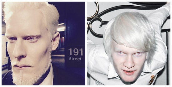 14 моделей-альбиносов, штурмующих мир моды