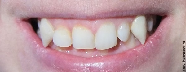 4. Вампирский ротик