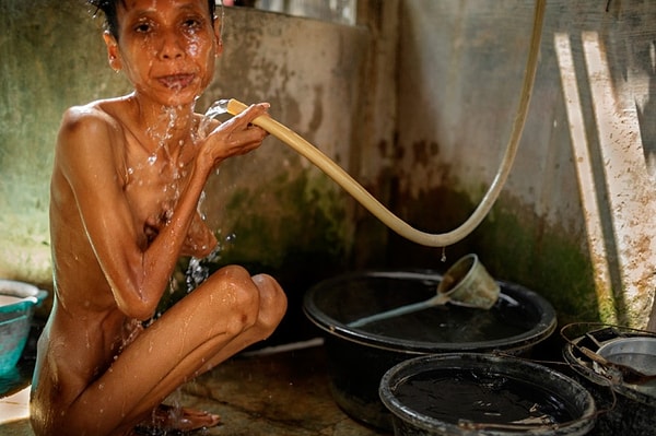 5. Целых 10 лет Анна жила в комнате без окон. И, по словам ее отца, ей совсем не нужно много еды. Раньше она любила убегать, но теперь проблема решена: Анна даже не может самостоятельно стоять на ногах.