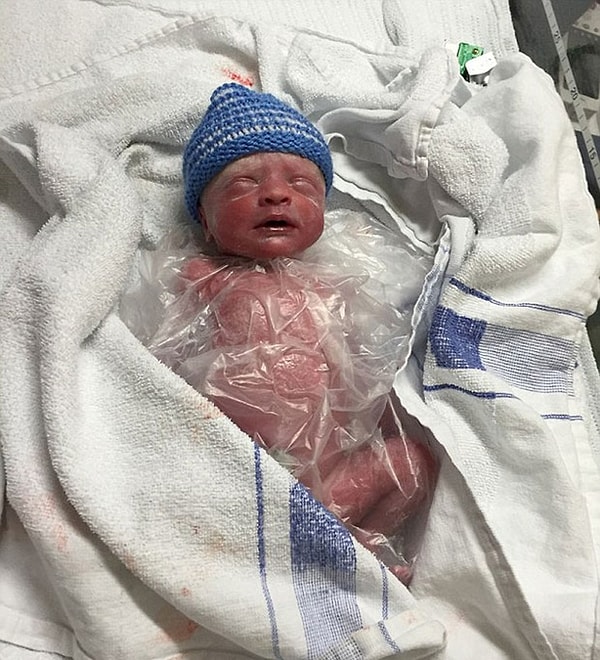 3. Практичные смекалистые доктора завернули малыша весом в 1 кг в пакет для бутерброда!