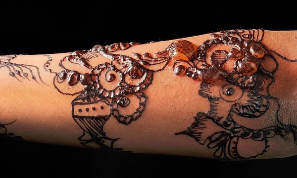 5. Аллергия на черную хну