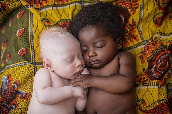 19. 3 haftalık albino bebek, kuzeniyle uyurken. Kinşasa, Demokratik Kongo Cumhuriyeti.