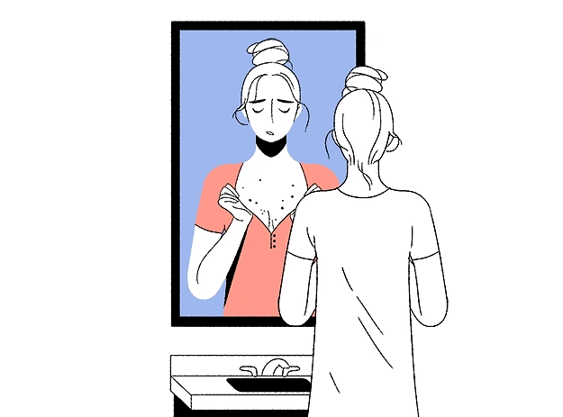 Когда ты думаешь, что ты уже взрослая и пубертатный период давно прошел, и на твоей груди появляется миллиард прыщиков