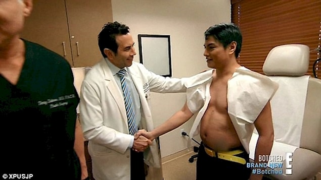 Geçen sene six pack isteyen Herbert, egzersiz yapmanın saçma olduğunu düşündü. Bunun yerine karnına MesoLipo adında dolgu enjekte ettirdi.