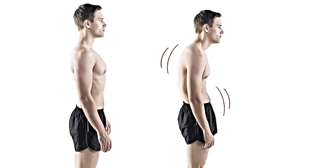 9 Things You Can Do To Fix Bad Posture