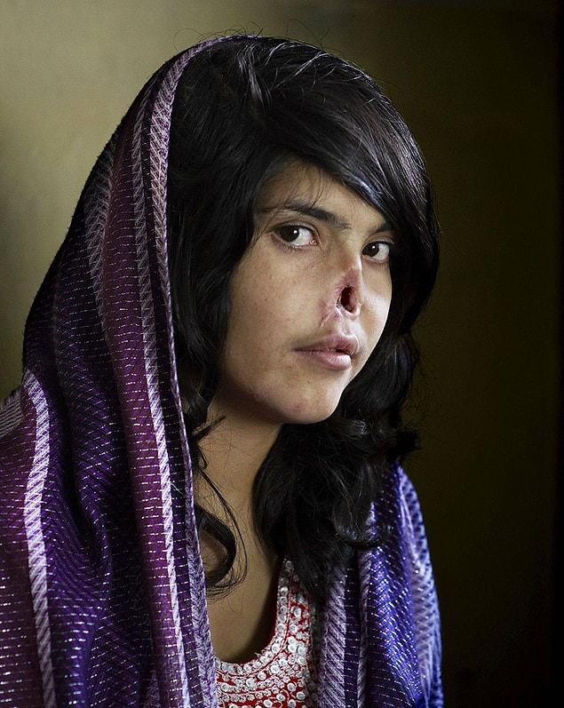 2. Courage: This Afghan woman was sold to her husband by her father. When she ran away from her husband, her ears and nose were cut as a punishment and she was sent back to her husband again.