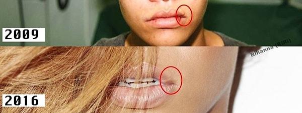 Rihanna, yaşadığı bu korkunç olaydan kalan izleri sadece yüzünde değil, hiç kuşku yok ki ruhunda da taşımaya devam etti.