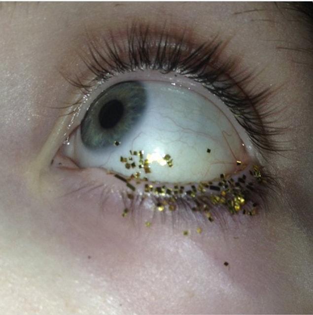 7. When glitter gets into your eye...