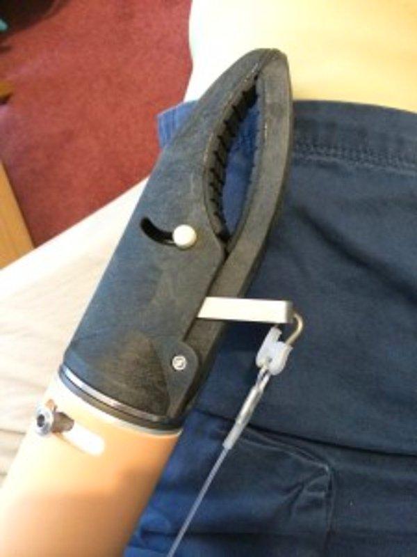 Üç buçuk ay hastanede kalan James'e standart birer protez kol ve ayak takılmıştı.