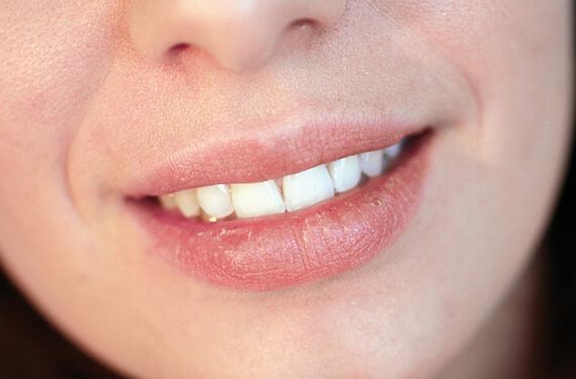 14. If you have chapped lips, you can use coconut oil to moisturize them.