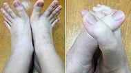 Bu Kadının, El Parmaklarına Benzeyen Aşırı Uzun Ayak Parmakları İnterneti Şaşkına Çevirdi