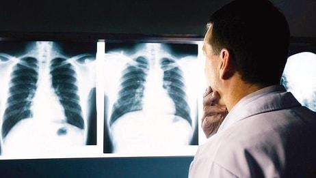 'Tıp Fakültesinde Görevli 12 Röntgen Teknisyeni Kanser Oldu' İddiası