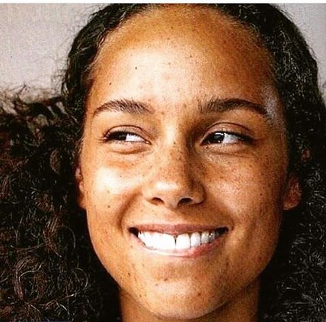She feels better and stronger now. She's been posing for magazines and photographers without make up since then.