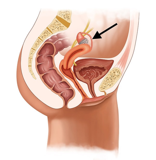 4. Что это за изогнутая розовая труба?
