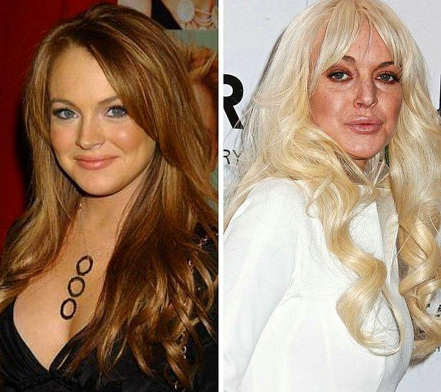 15 Celebrities Who Looked Way Better Before Plastic Surgery