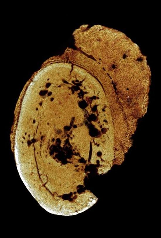 Dünyanın En Eski Kanser Vakasına 1.7 Milyon Yıllık Bir Fosilde Rastlandı