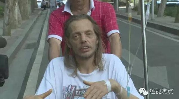 Через 10 дней его госпитализировали с физическим истощением.