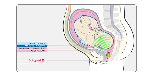 There are already plenty of parents who value playing music for their unborn child.