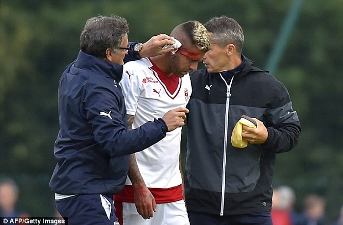 Bordeauxlu Menez'in, Yeni Takımıyla Çıktığı İlk Maçta Kulağının Bir Kısmı Koptu!