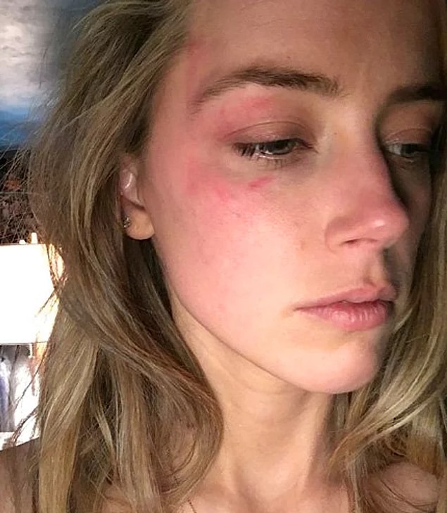 Amber Heard'ün annesini yeni kaybetmiş Depp'i boşamasının nedeni, gördüğü şiddetti!