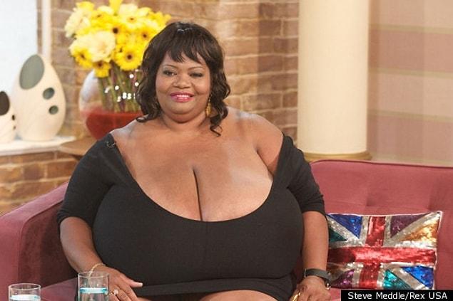 3. The woman who has the largest breasts on earth!