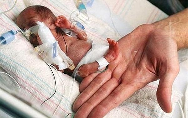 Hamileliğin 26. haftasında bebeğin ailesiyle konuşan Prof Dr Sven Schiermeier sezeryan doğum yönünde karar verdi. Çünkü plasentadan kaynaklanan bir sorun yüzünden Emilia rahim içinde yeterli beslenemiyordu.