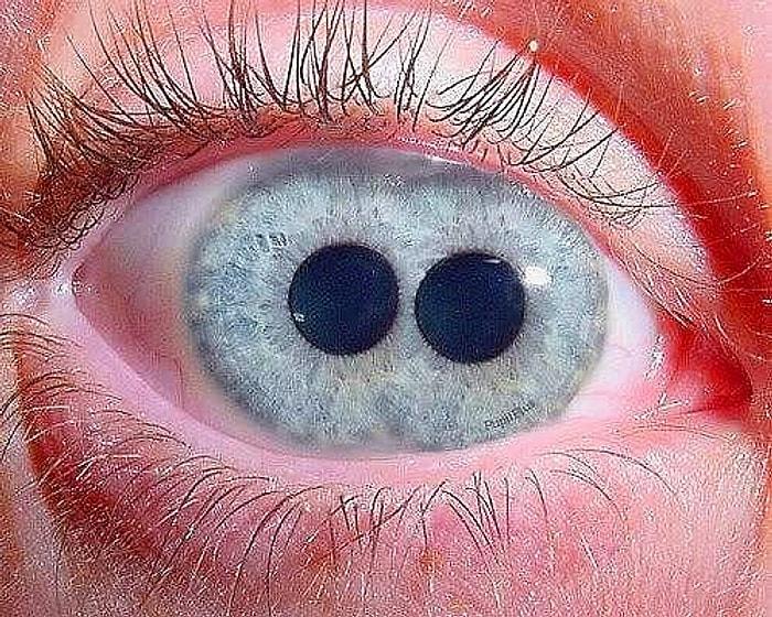 Çift Göz Bebeği Olanların Bile Zorlanacağı Bu Dikkat Testini Sadece %13'ünüz Geçebilecek!