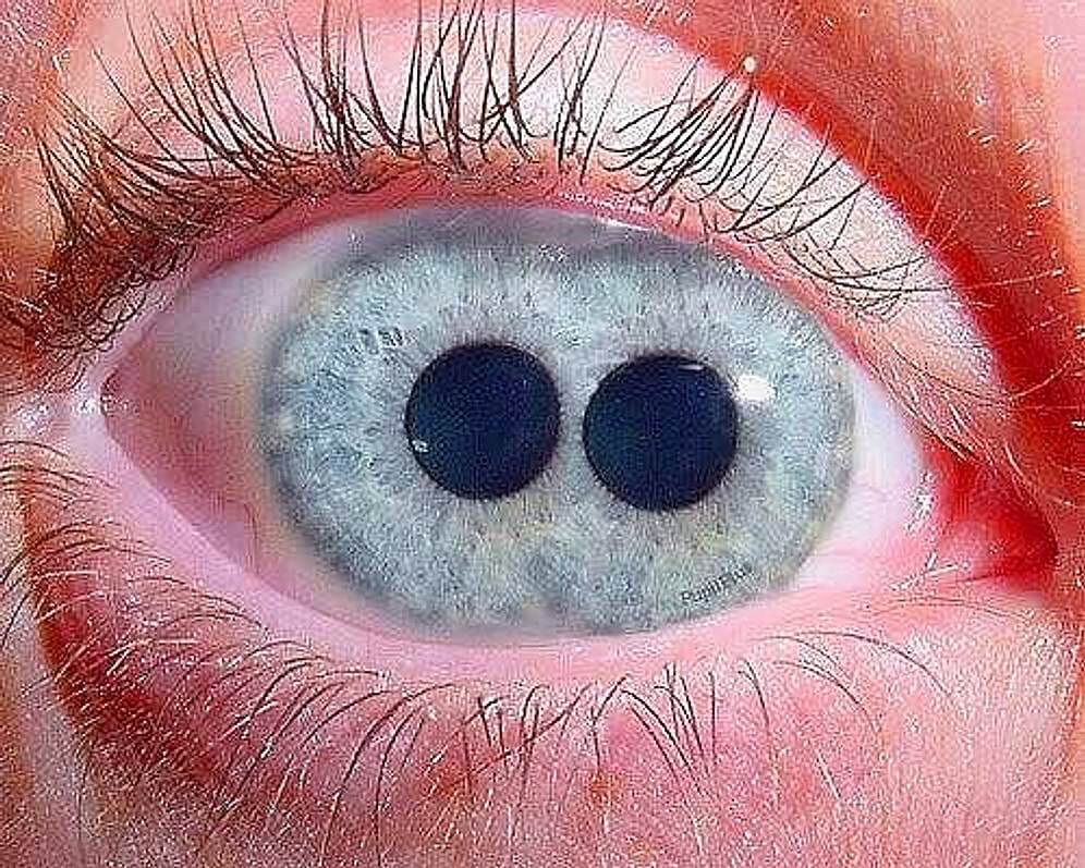 Çift Göz Bebeği Olanların Bile Zorlanacağı Bu Dikkat Testini Sadece %13'ünüz Geçebilecek!