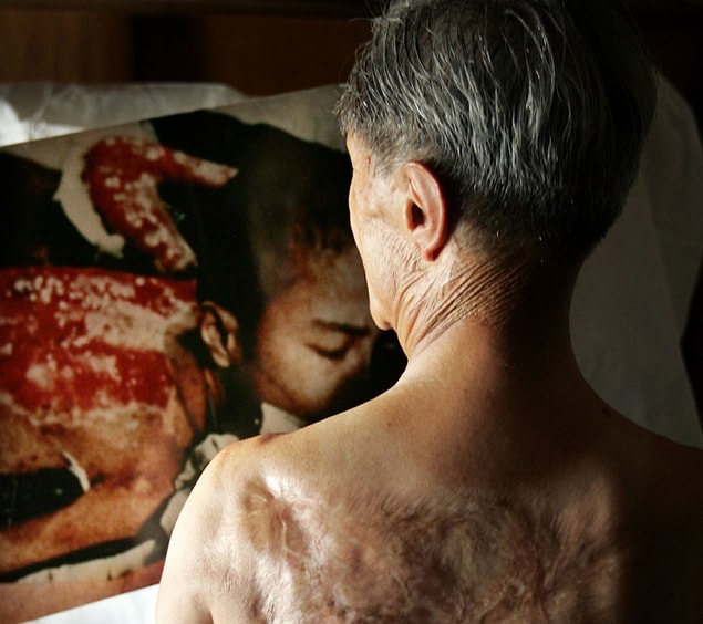 2. Tsutomu Yamaguchi 2.Dünya Savaşı sırasında hem Hiroşima hem de Nagasakiye atılan atom bombalarından sağ salim kurtulan kişiydi.