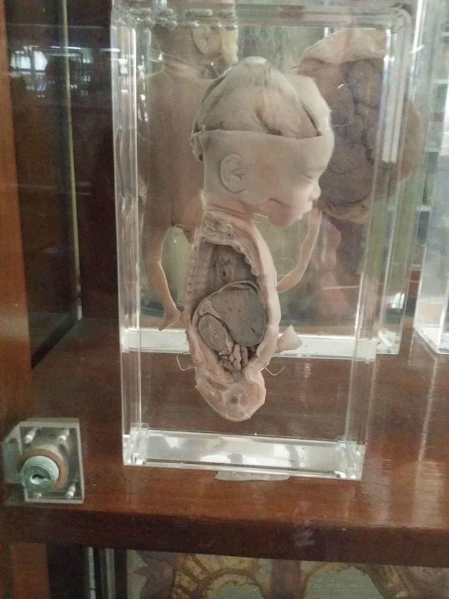 12. The corpse of a 6-month old baby