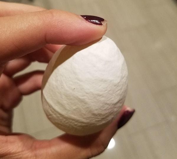 25. Bu yumurta sinirli mi?😱