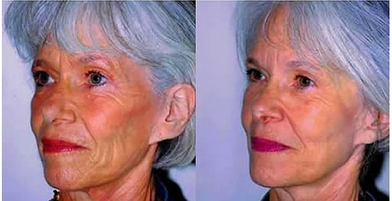 Как выглядят сестры и братья-близнецы, один из которых курит, а другой - нет