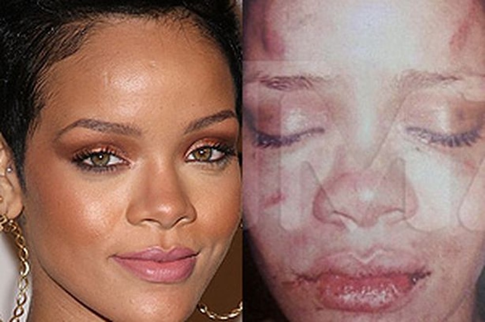 Şiddet Sadece Tanımadığınız Erkeklerden Gelmez: Flört Şiddetine Uğradığınızı Gösteren 18 Belirti