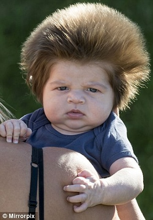 Of the 28 women who reported moderate to severe heartburn, 23 had babies with average or above-average amounts of hair.