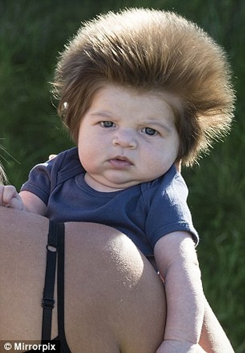 Of the 28 women who reported moderate to severe heartburn, 23 had babies with average or above-average amounts of hair.