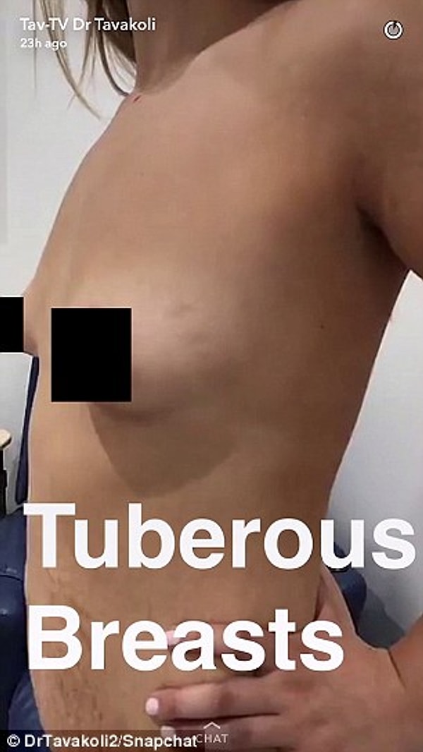 Разумеется, он просит у них разрешение на такого рода публикации. Обычно около 50% клиенток отвечают на просьбу положительно.