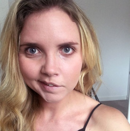 Девушка победила паралич лицевого нерва с помощью селфи!