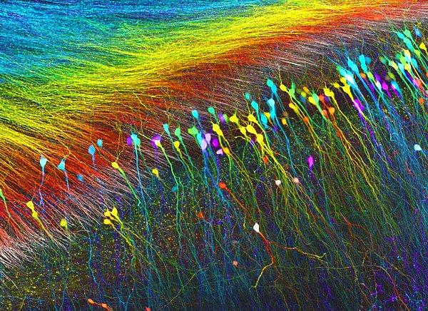 17. İnsan Beynindeki Nöronlar