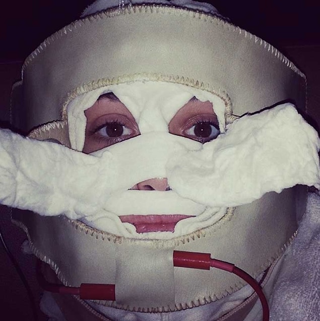 1. Emmy Rossum bu fotoğrafta bir ameliyattan henüz çıkmış falan değil!