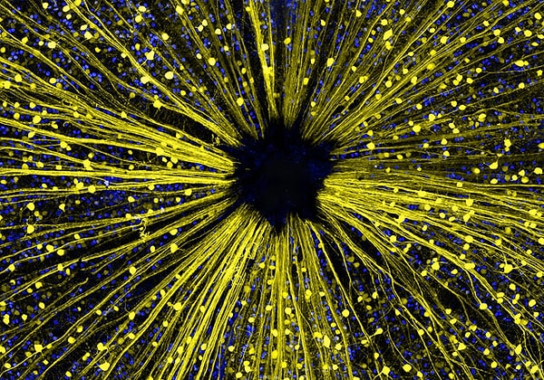 14. Ганглиозные клетки сетчатки глаза мыши. Работа Кеунянга Кима.