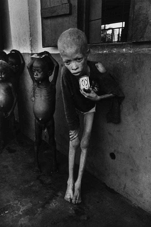 62. Albino Çocuk, Biafra - 1969