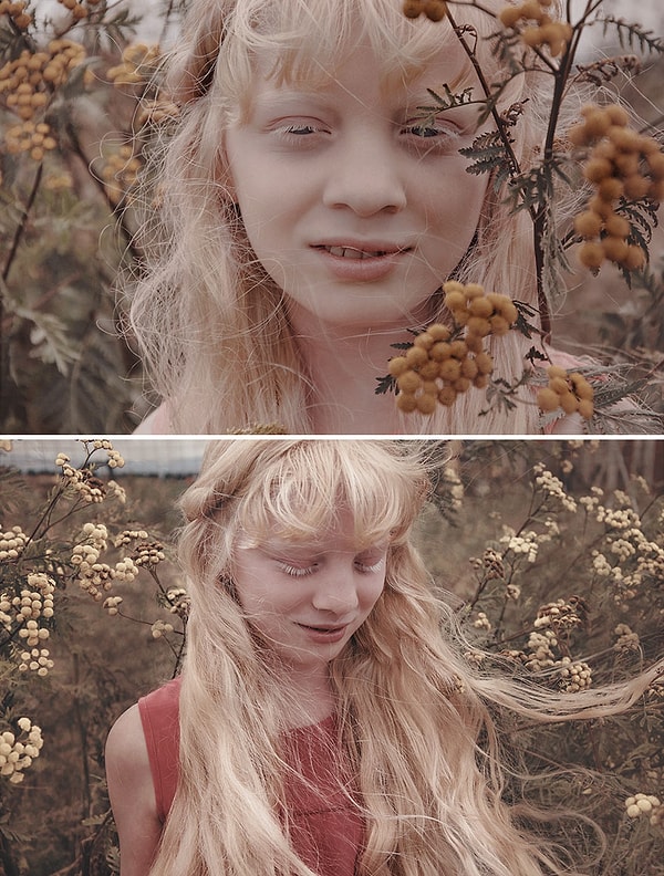 18. Девочка-альбинос