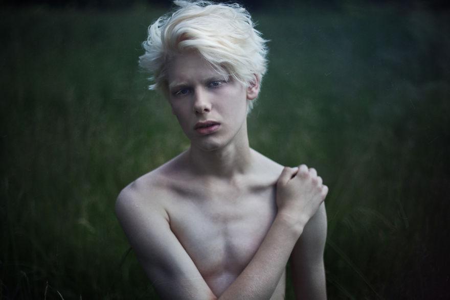 19. Парень-альбинос.