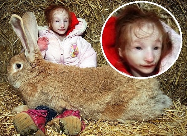 17. Шарлотта Гарсайд - самая маленькая девочка в мире