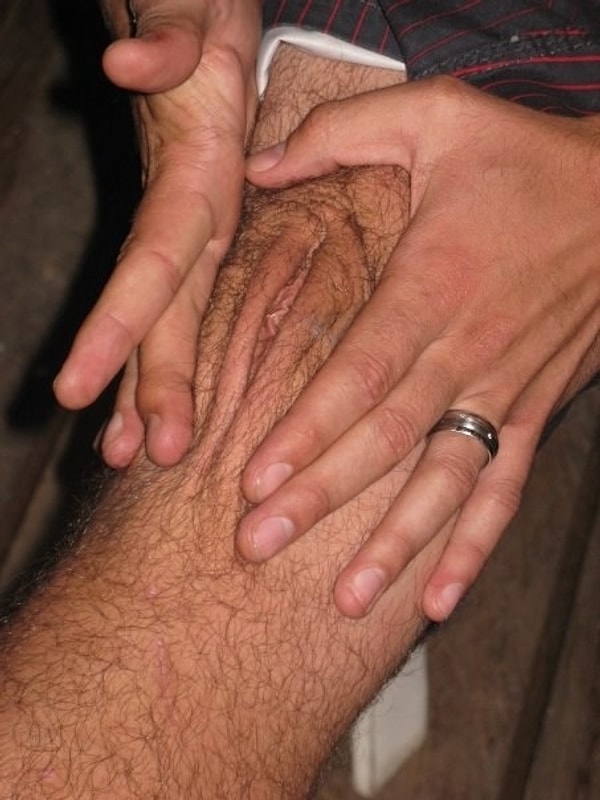 15. Это просто кожа на коленке. А ты что подумал?